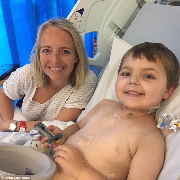 Aged Three James Lewis Right Was Diagnosed With An Incurable Heart Condition
