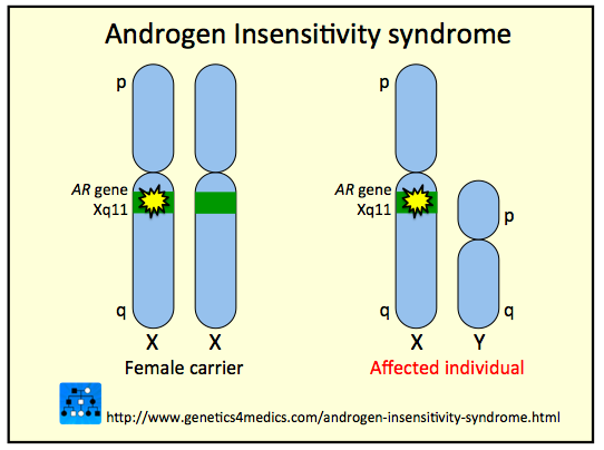 Androgen Insensitivity Syndrome Androgen Insensitivity Syndrome