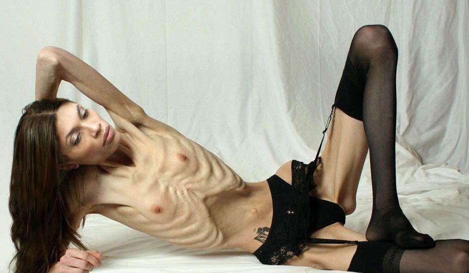 Anorexic Nudes For Skinny Fans Bernadinism 1