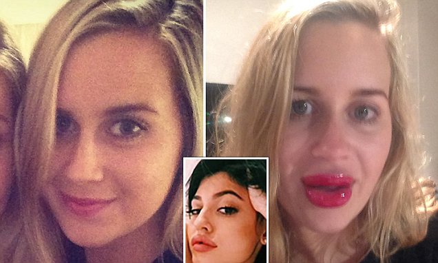 Australian Woman Buys A Lip Enhancer Online And The Results Are Not What She Expected Daily Mail Online