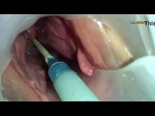 Crystal Meth Injected Into Asshole Free Videos Watch Download 1