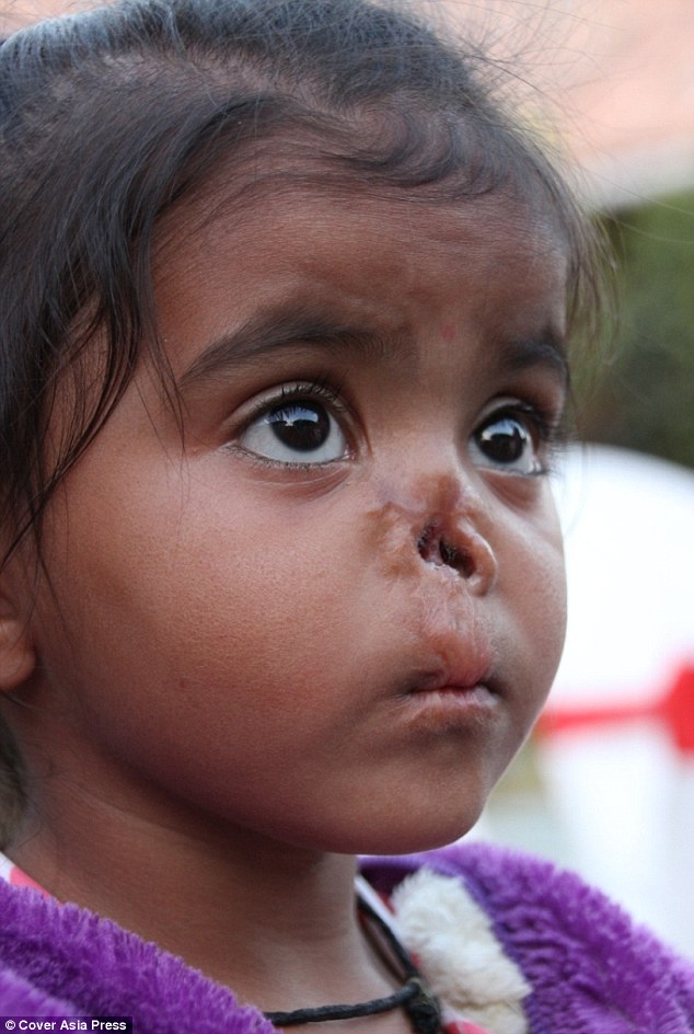 Durga Was Abandoned At Birth Since Then Many Parents Have Rejected Her Because Of Her