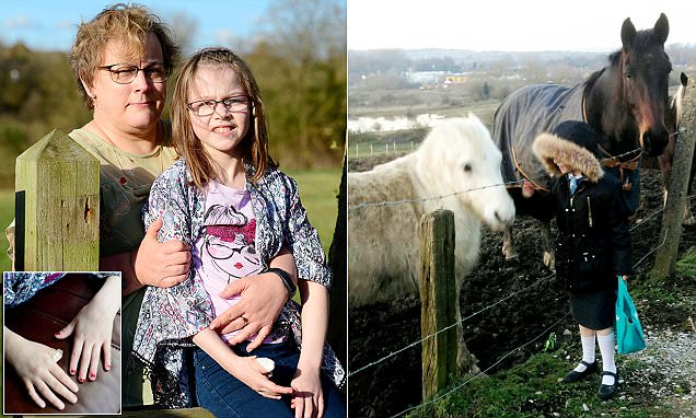 Horse Bites Off A Young Girls Right Thumb As She Fed It A Carrot Through A Fence Daily Mail Online