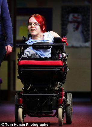 Joanne Oriordan Who Was Born With No Arms Or Legs But With
