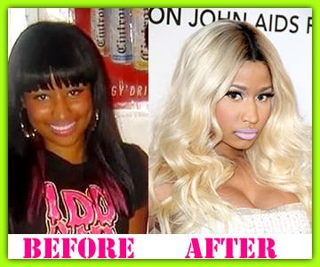 Nicki Minaj Plastic Surgery Before And After Nicki Minaj Plastic Surgery Nickiminaj
