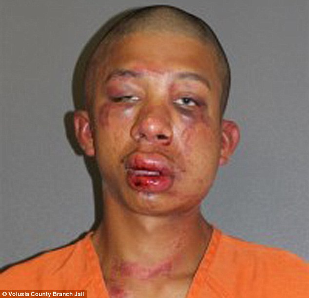 Raymond Frolander Pictured In His Mugshot Was Beaten To A Pulp