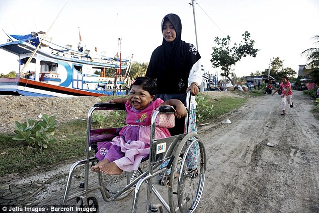 Sari Is Unable To Walk And Has To Rely On Her Relatives To Push Her Around