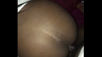 Stretch Marks Ass Search