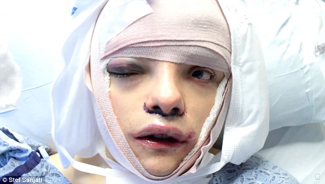 The Year Old Transgender Woman From Toronto Recently Underwent Facial Feminisation Surgery